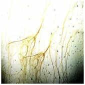 Womb